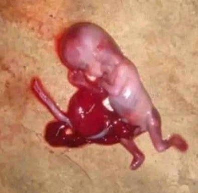 Fetus Discovered Abandoned in Port Harcourt, Rivers State